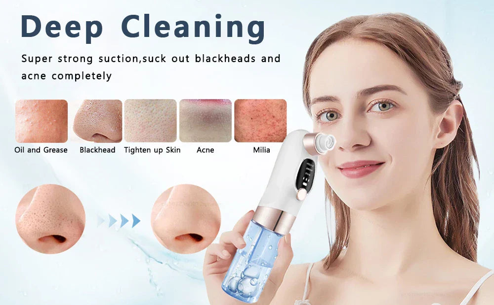 Electric Pore Vacuum Blackhead Remover with Microbubble Technology