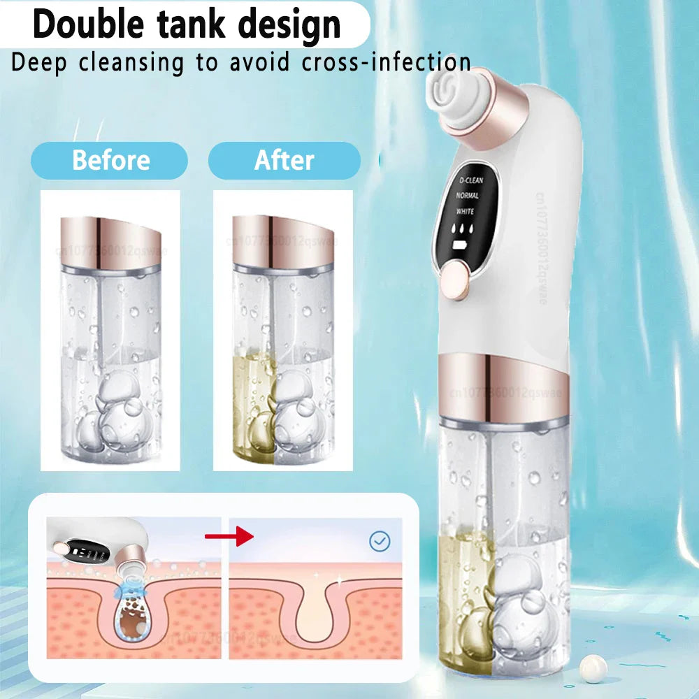 Electric Pore Vacuum Blackhead Remover with Microbubble Technology