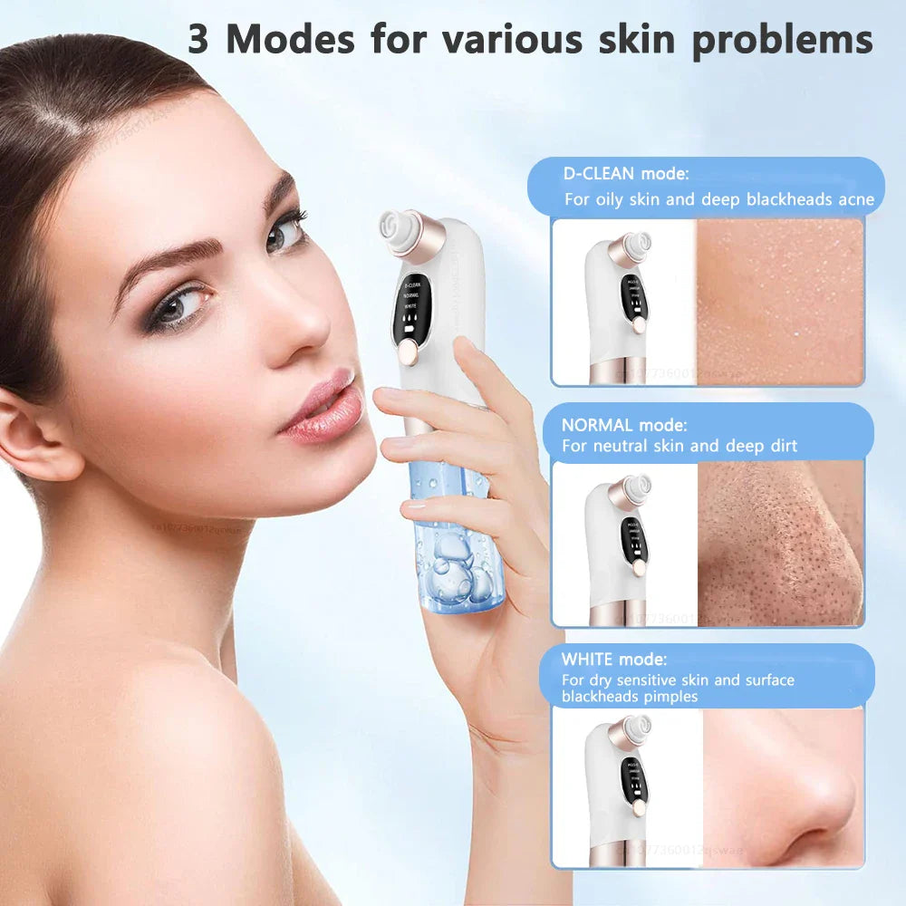 Electric Pore Vacuum Blackhead Remover with Microbubble Technology