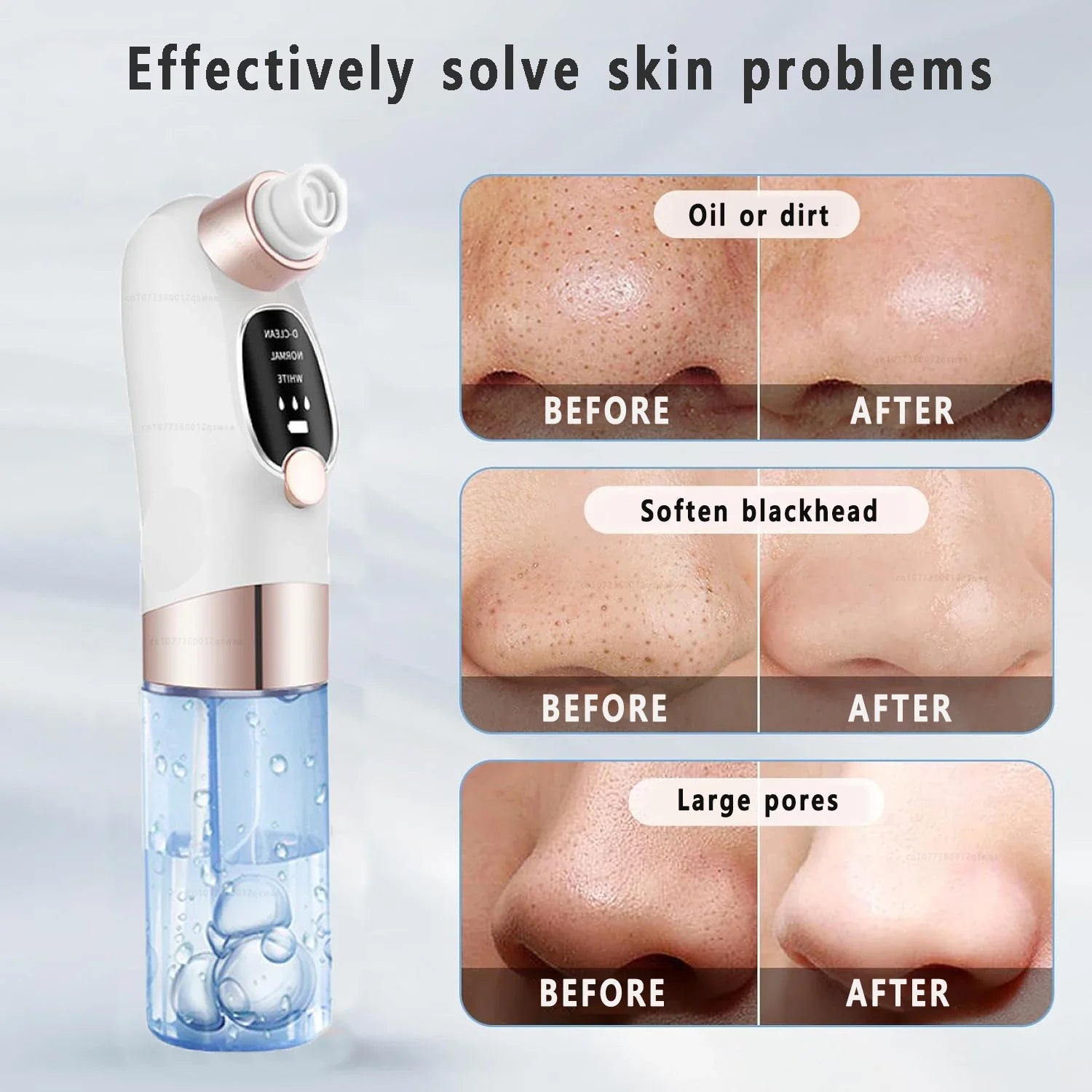 Electric Pore Vacuum Blackhead Remover with Microbubble Technology