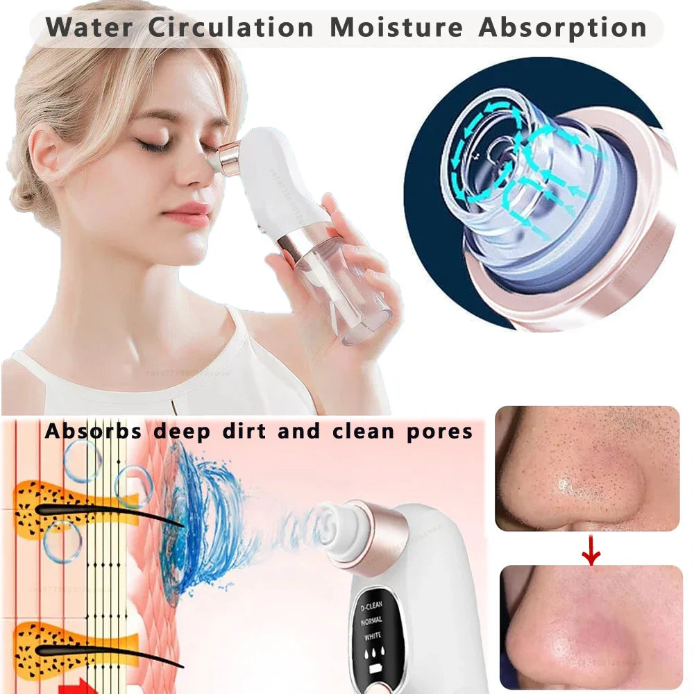 Electric Pore Vacuum Blackhead Remover with Microbubble Technology